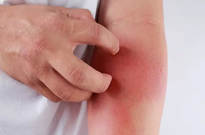 Nguyên Nhân Nào Gây Ra Nấm Mốc Trên Thảm Lót Sàn Ô Tô?
